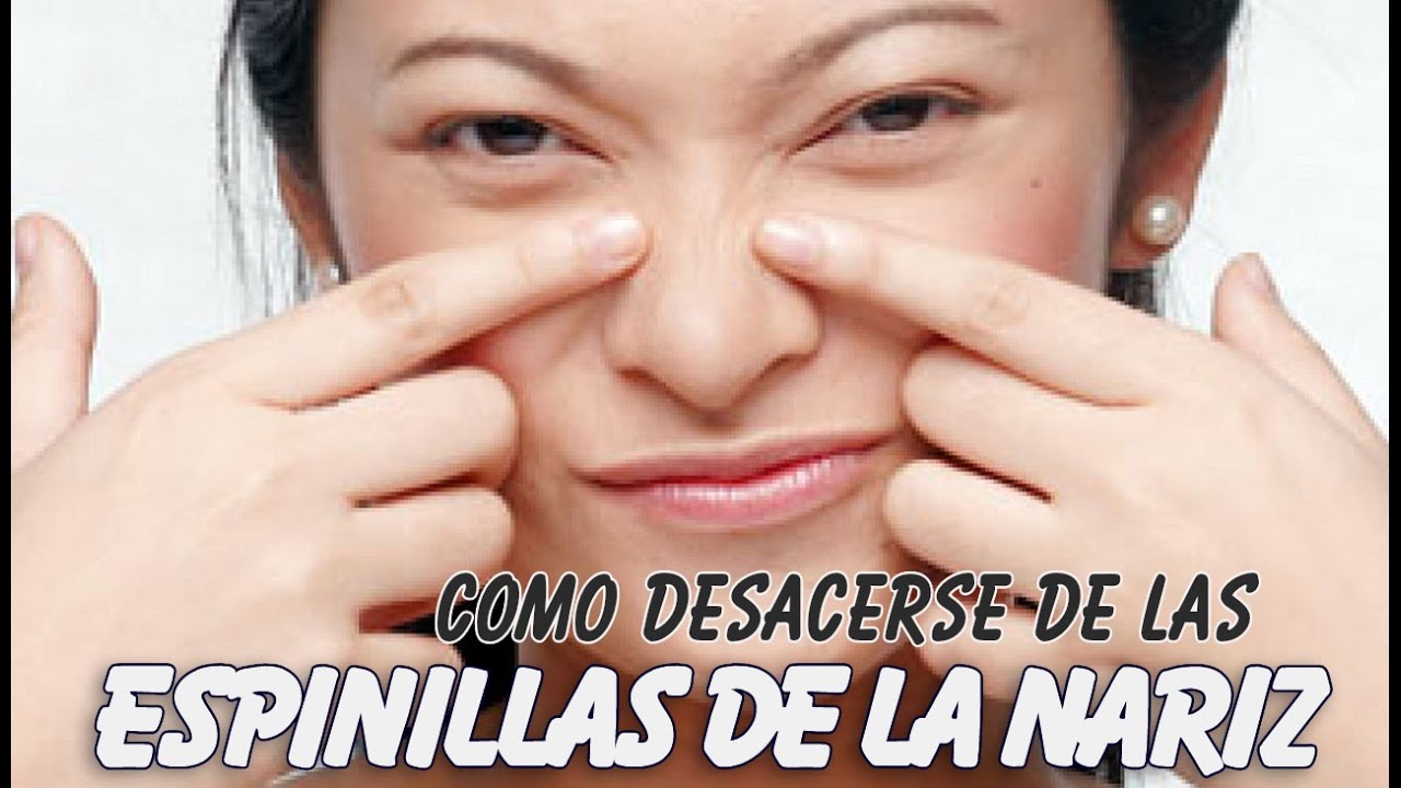Como deshacerse de las espinillas obstinadas en su nariz